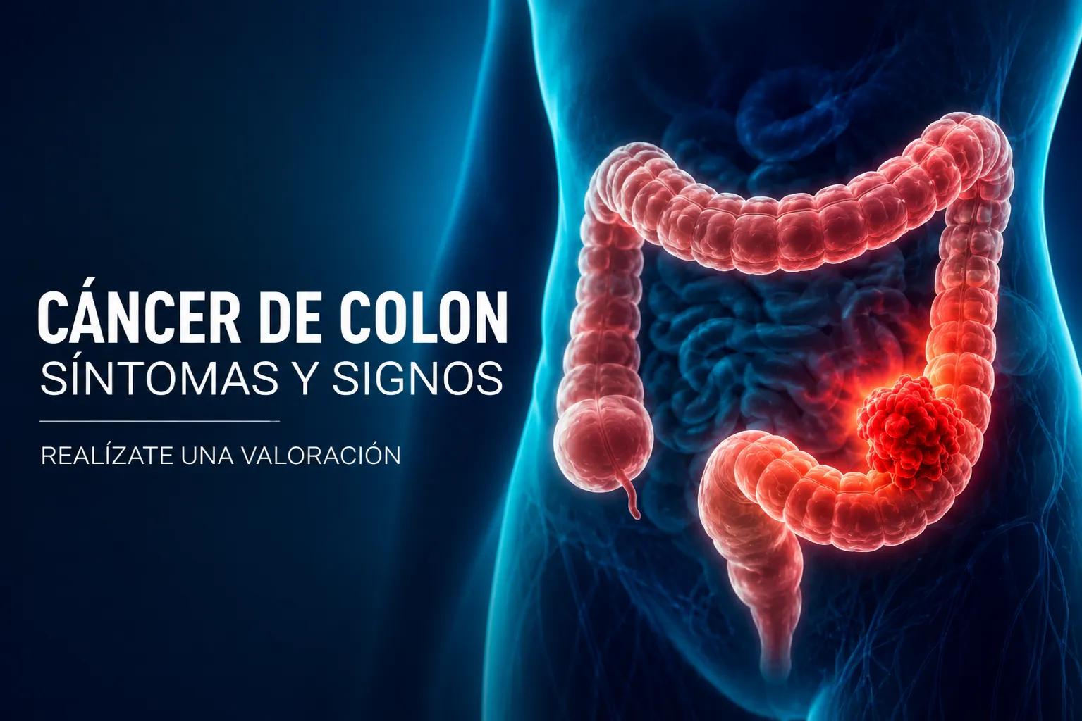 Ilustración del colon y detección de cáncer colorrectal